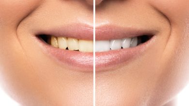 Transforme seu sorriso: dicas para clarear os dentes em casa